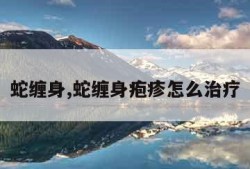 蛇缠身,蛇缠身疱疹怎么治疗
