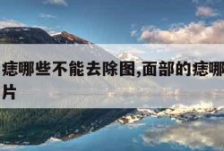 面部的痣哪些不能去除图,面部的痣哪些不能去除图片